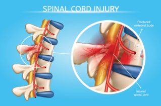 spinal_cord_injury