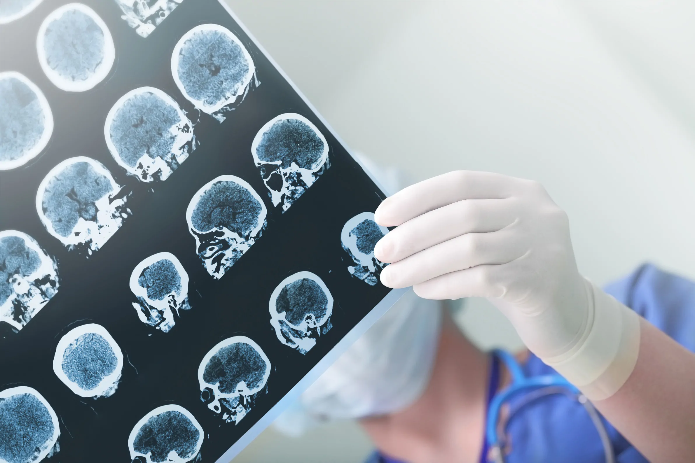 Brain Injury Lawyer in Miami
